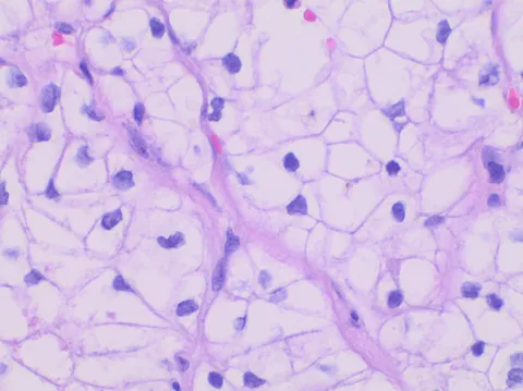 Cancer AI Alliance: Uniting Titans to Unleash the Power of AI Against Cancer