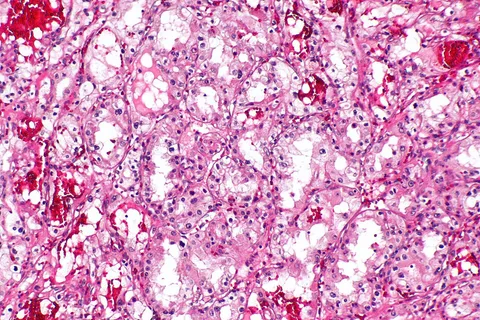 Callio Therapeutics: Pioneering Multi-Payload Cancer Treatments with $187 Million Backing