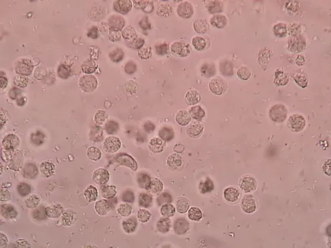 From Startup to Nobel: How Darwin Molecular Revolutionized Autoimmune Research